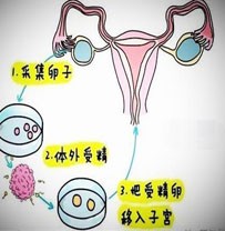 闭经后做第三代供卵试管婴儿的成功率是多少？