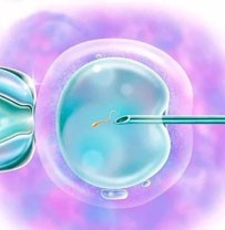 染色体平衡易位-悔恨的试管之路，该怎么办？,试管婴儿,试管过程