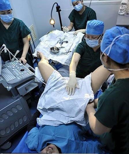 试管婴儿手术现场