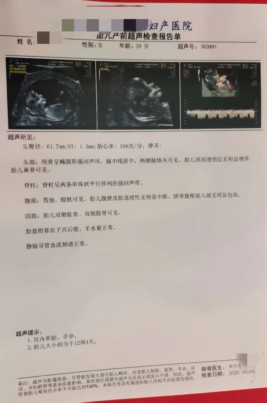 3代试管婴儿多少钱