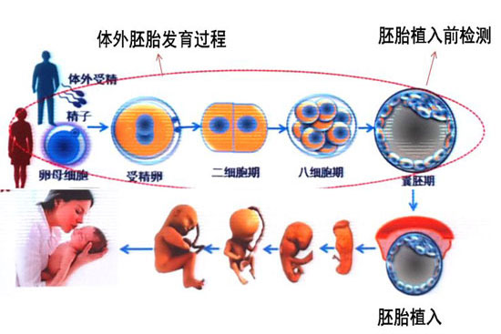 什么是第三代试管婴儿