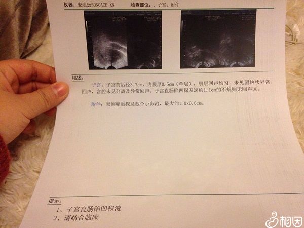 B超检查单