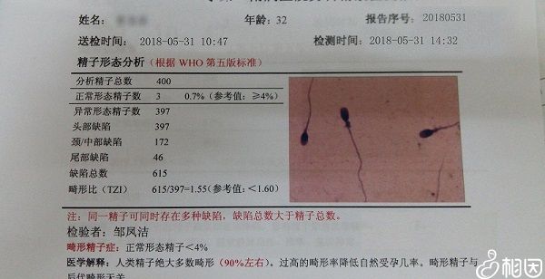 畸形精子症